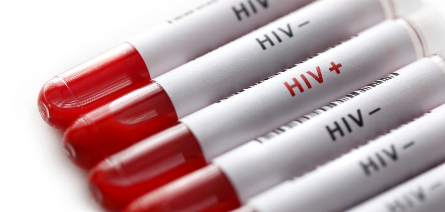 Arī Lietuvā labas ziņas HIV pacientiem: bezmaksas ārstēšana pieejama ātrāk